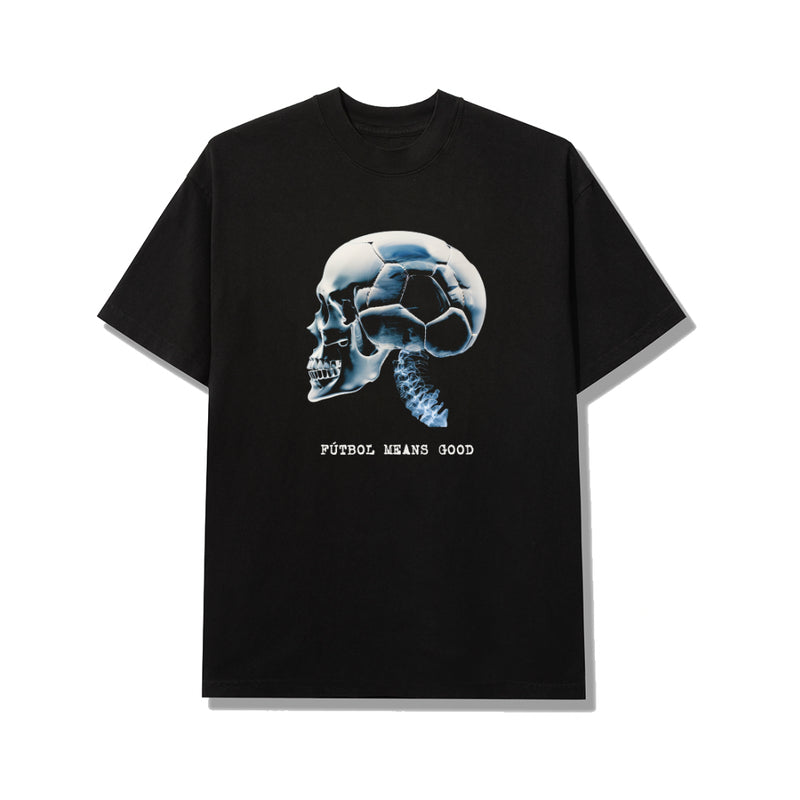 Skull Tee - Black